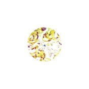 Precision Reticulum Stain Kit